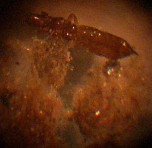Pest Infestation in Sampler Pesr Infestation in Sampler