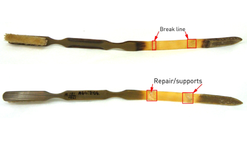Whalebone Toothbrush After Treatment Whalebone Toothbrush After Treatment